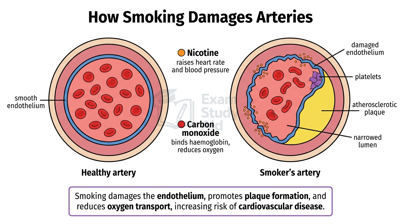 Healthy artery beside a smoker's artery showing how nicotine raises blood pressure and carbon monoxide reduces oxygen, causing endothelial damage, plaque and a narrowed lumen.