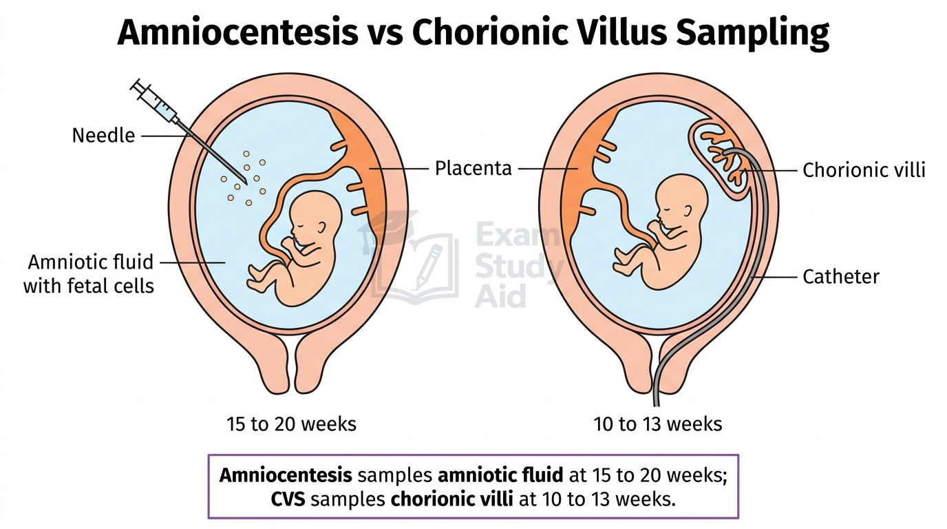 Diagram comparing amniocentesis sampling amniotic fluid at 15 to 20 weeks with chorionic villus sampling of placental villi via catheter at 10 to 13 weeks.